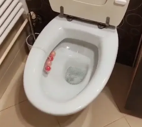 WC školjka nakon uklanjanja kamenca
